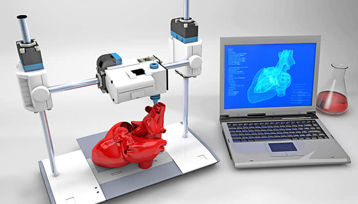 3D Printing in Medicine: Custom Prosthetics and Organ Transplants